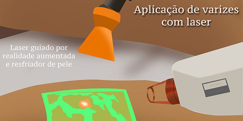 laser-transdermico_Easy-Resize.com